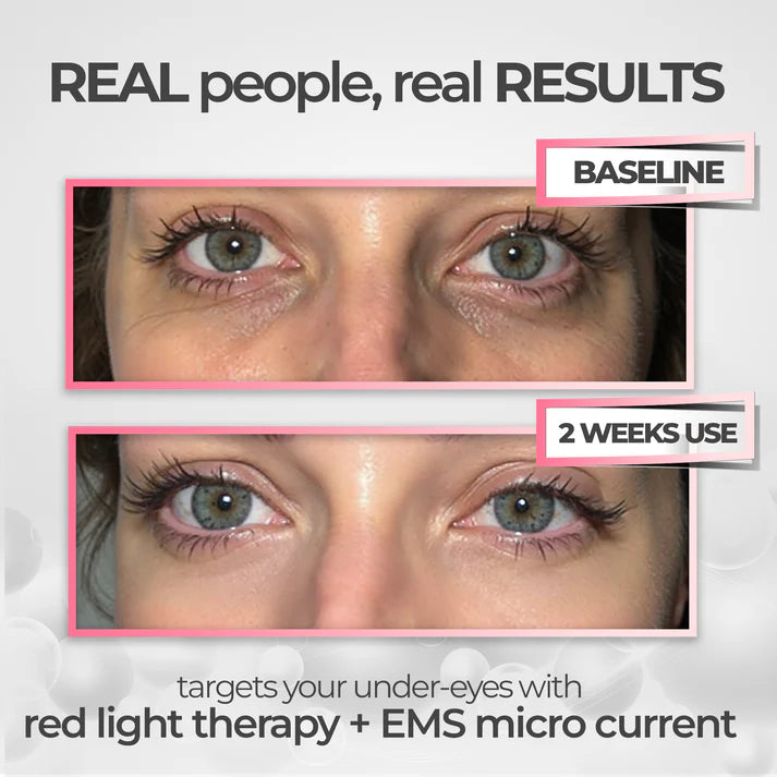 Prime Eye Renewal®