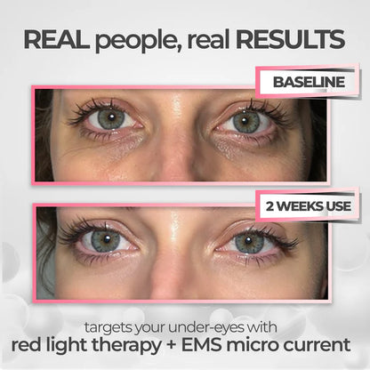 Prime Eye Renewal®