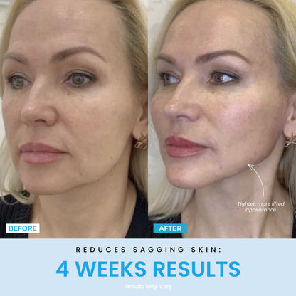 Prime Contour®