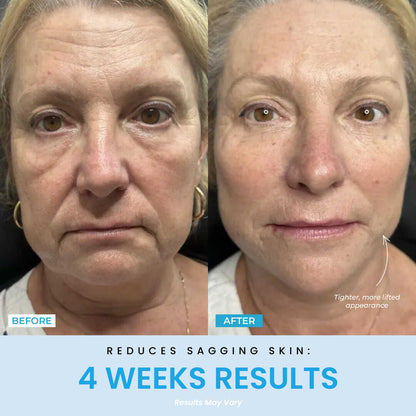 Prime Contour®