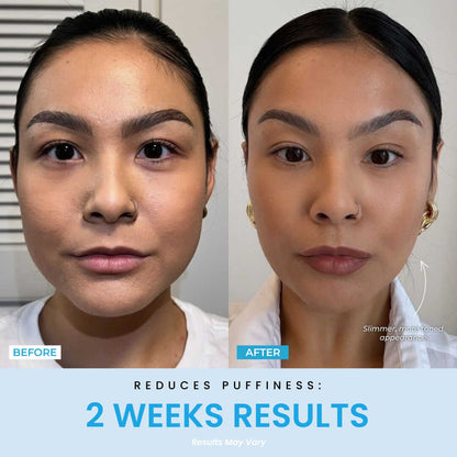Prime Contour®