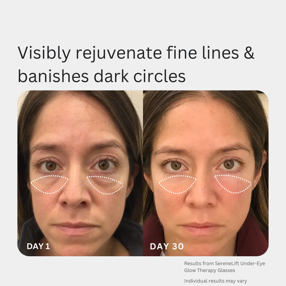Prime Eye Renewal®