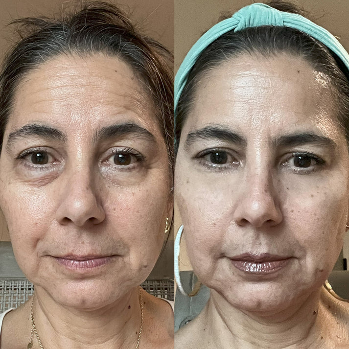 Prime Eye Renewal®
