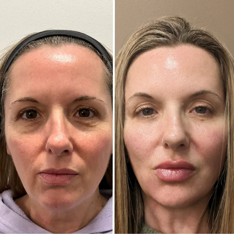 Prime Eye Renewal®