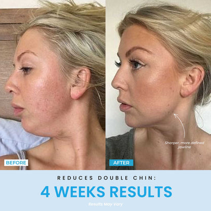 Prime Contour®