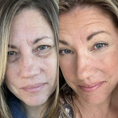 Prime Eye Renewal®