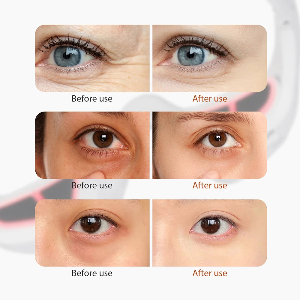 Prime Eye Renewal®